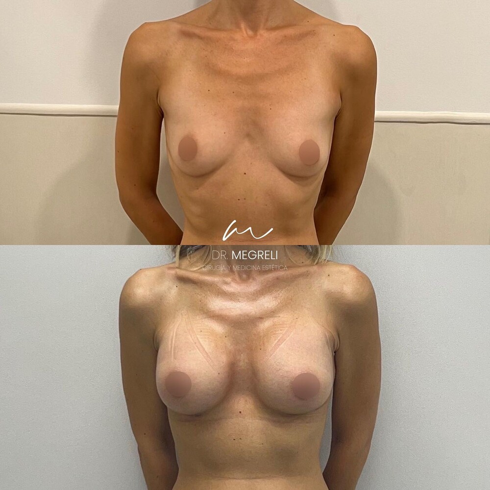 Before and After Result